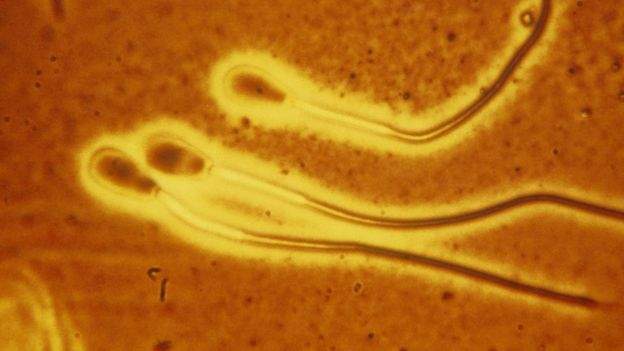 Scientist Revealed New Finding For Swimming Of Bunch Of Sperms In Gloopy Liquid