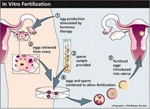 How Laboratory Conditions Can Lead to Successful IVF Treatment?