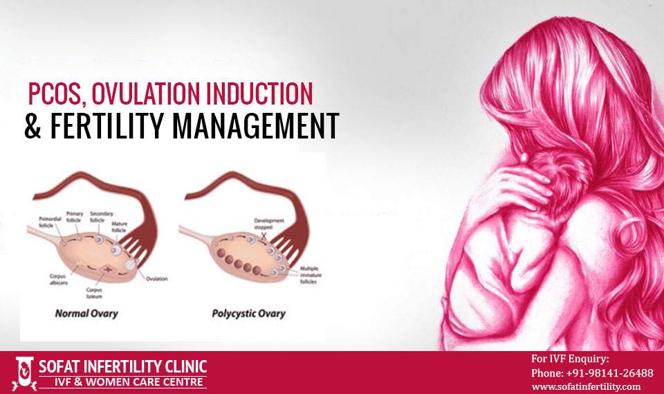 PCOS, Ovulation Induction & Fertility Management