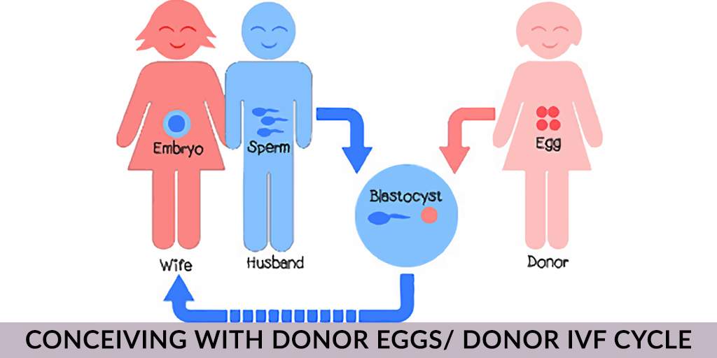 Conceiving With Donor Eggs/ Donor IVF Cycle