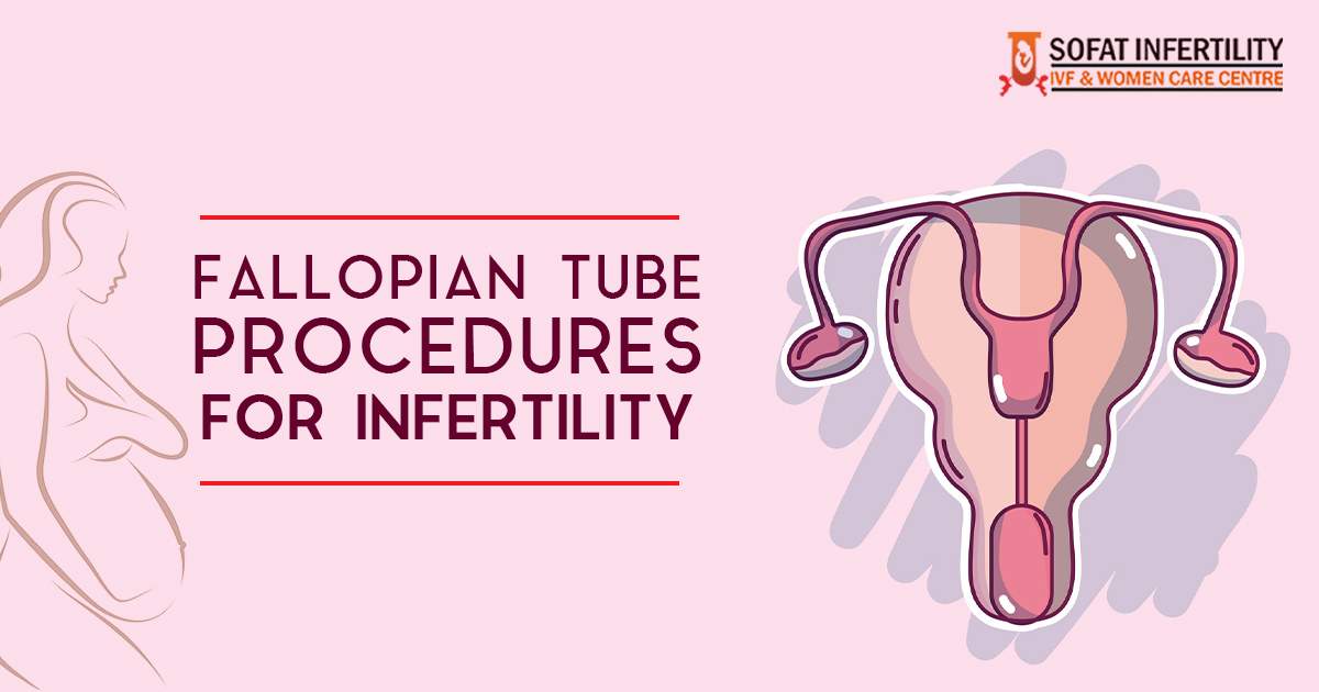 Fallopian tube procedures for infertility