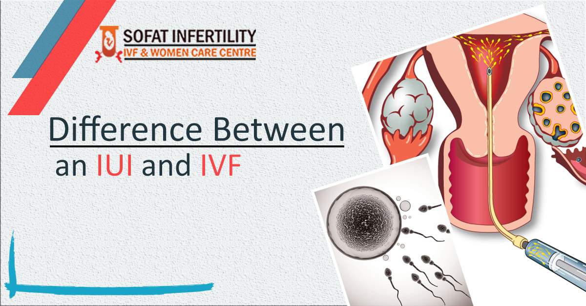 Infertility Treatment What is the difference between an IUI and IVF